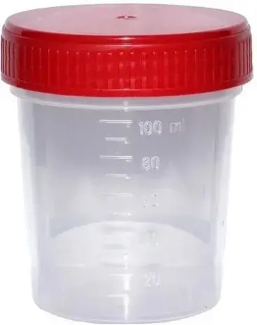 Przejdź do produktu Pojemnik na mocz sterylny 100 ml Margomed do badań laboratoryjnych – jałowy, jednorazowy